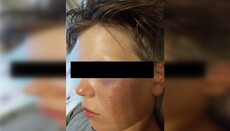 СМИ: В Киргизии мальчика избили из-за того, что он русский и православный