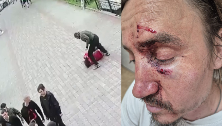 Священник УПЦ отец Роман был избит боевиками возле собора в Черновцах. Фото: СПЖ
