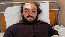 Ο ξυλοκοπημένος ιερέας στο Τσερνιβτσί προς τον Βαρθολομαίο: Το αίμα μας είναι στη συνείδησή σας