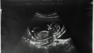 The number of abortions in Great Britain has reached a record high in history. Photo: Getty/iStock