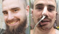 На Буковині просять молитов за важко пораненого сина священника УПЦ