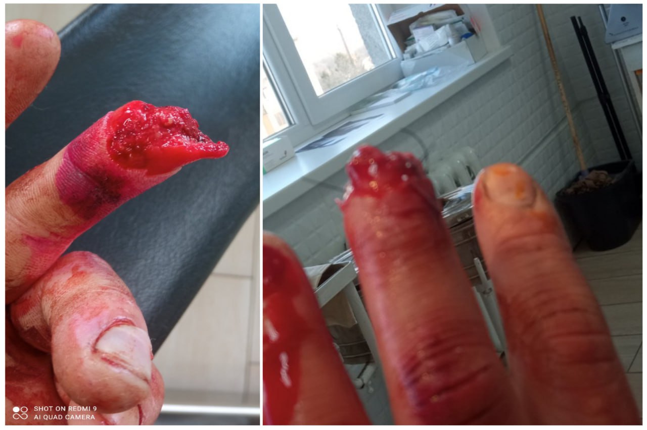 Yurkivtsi: OCU raiders cut off a UOC believer's fingertip with a crowbar фото 1